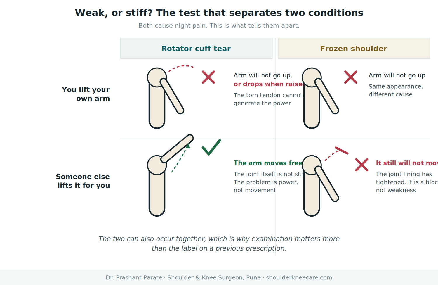 Rotator cuff tear versus frozen shoulder: weakness compared with stiffness