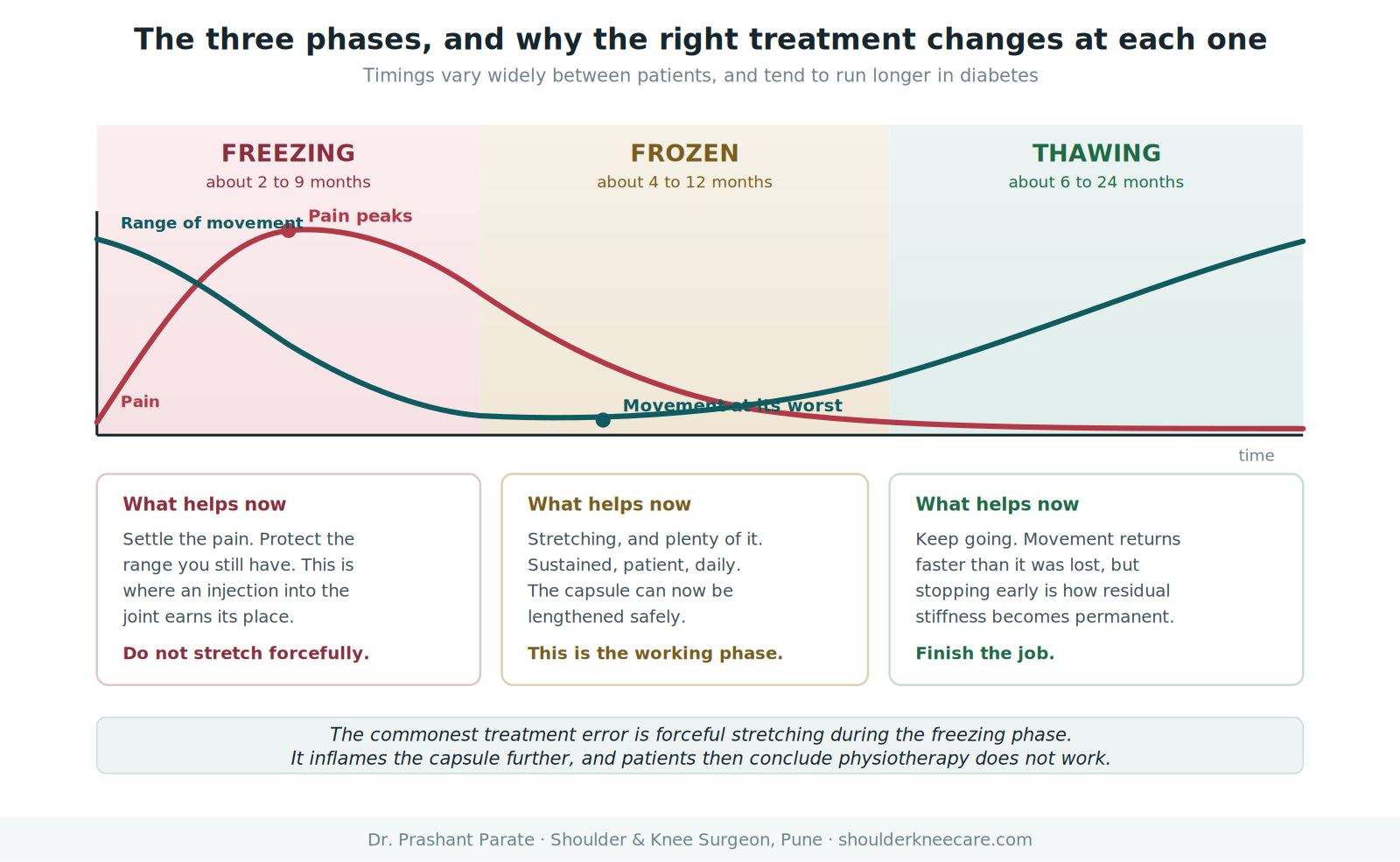 Frozen shoulder three phases: freezing, frozen and thawing, with correct treatment at each stage